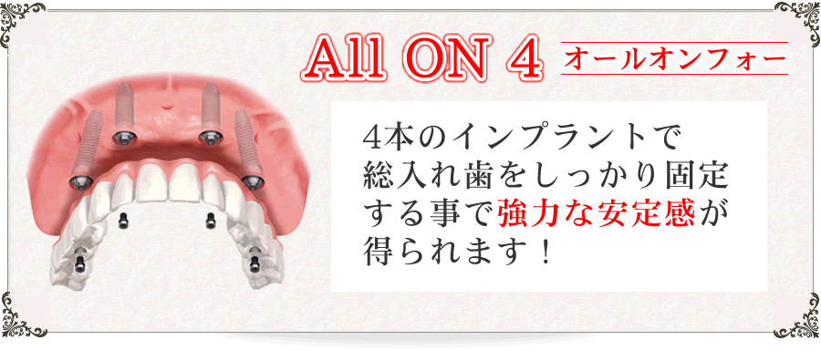 オールオン4　4本のインプラントで総入れ歯をしっかり固定することで強力な安定感が得られます。